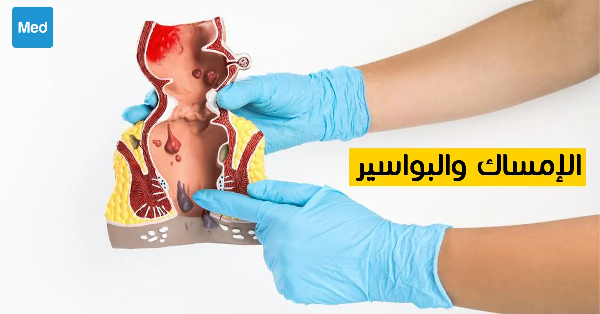 الإمساك والبواسير